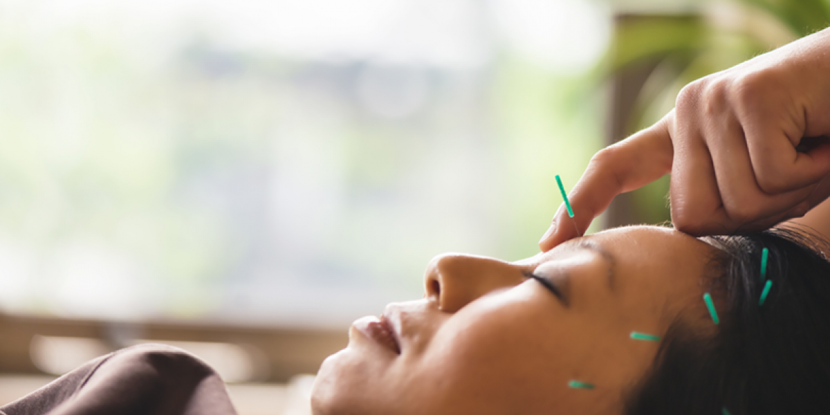 Woman receiving acupuncture treatment on her face.